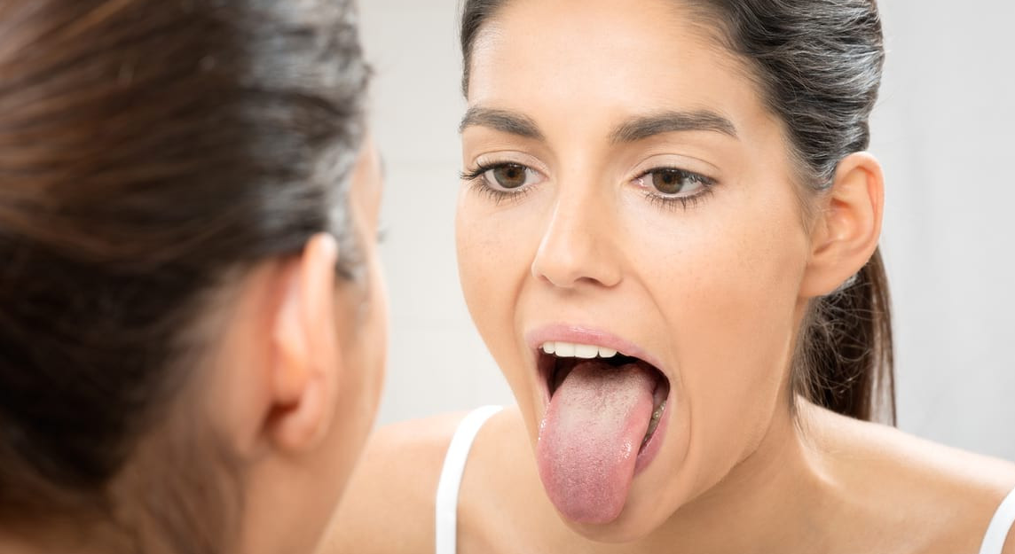 Black spot on tongue